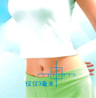 妇科腹腔镜微创手术能诊治哪些疾病?